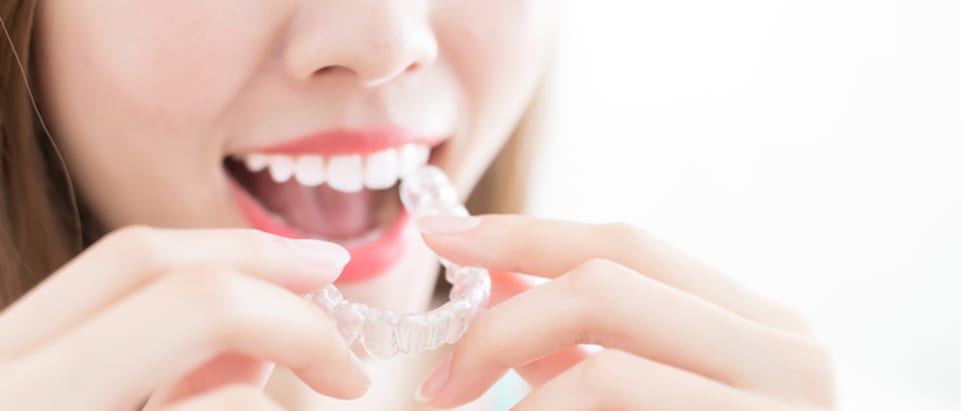 Why is wearing a retainer so important? 1